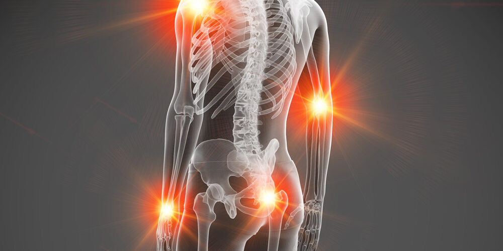 power-relief-blog-joint-pain