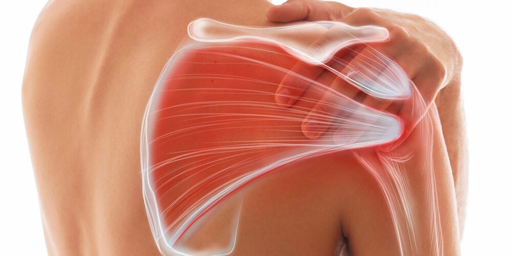 power-relief-blog-muscle-pain